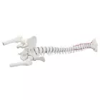 anatomisches Modell, Wirbelsäule mit Bandscheibenvorfall, Becken und Oberschenkelstümpfen, ohne Stativ